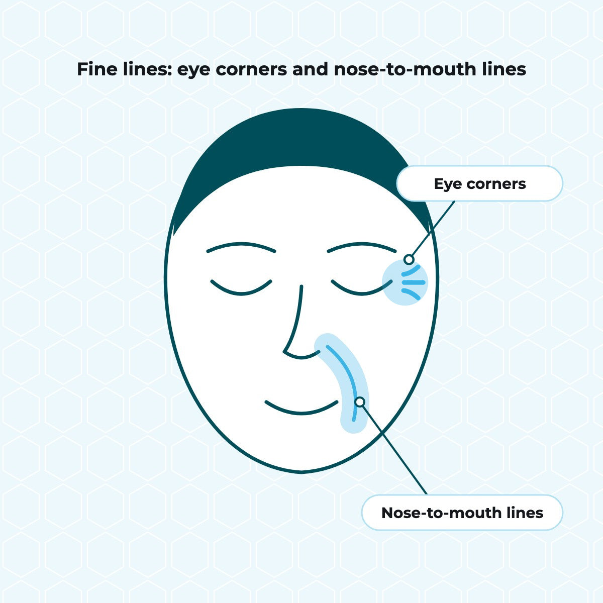 Face line drawing marking the eye corners and the lines from the nose to the mouth