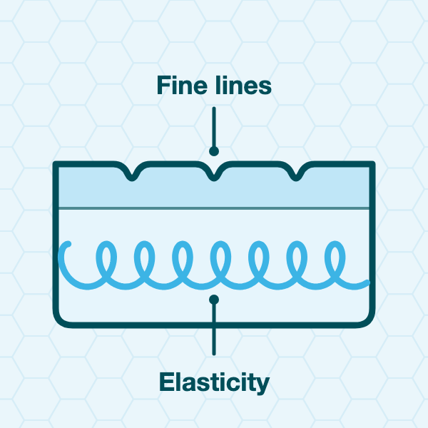 Flat diagram: skin cross-section showing fine lines on the surface and a row of spring-like fibres below (illustrates structure only)