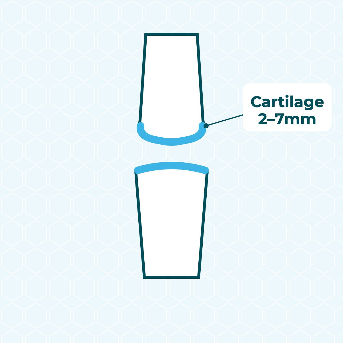 Cross-section of a joint: a 2–7mm layer of cartilage covers the ends of the bones
