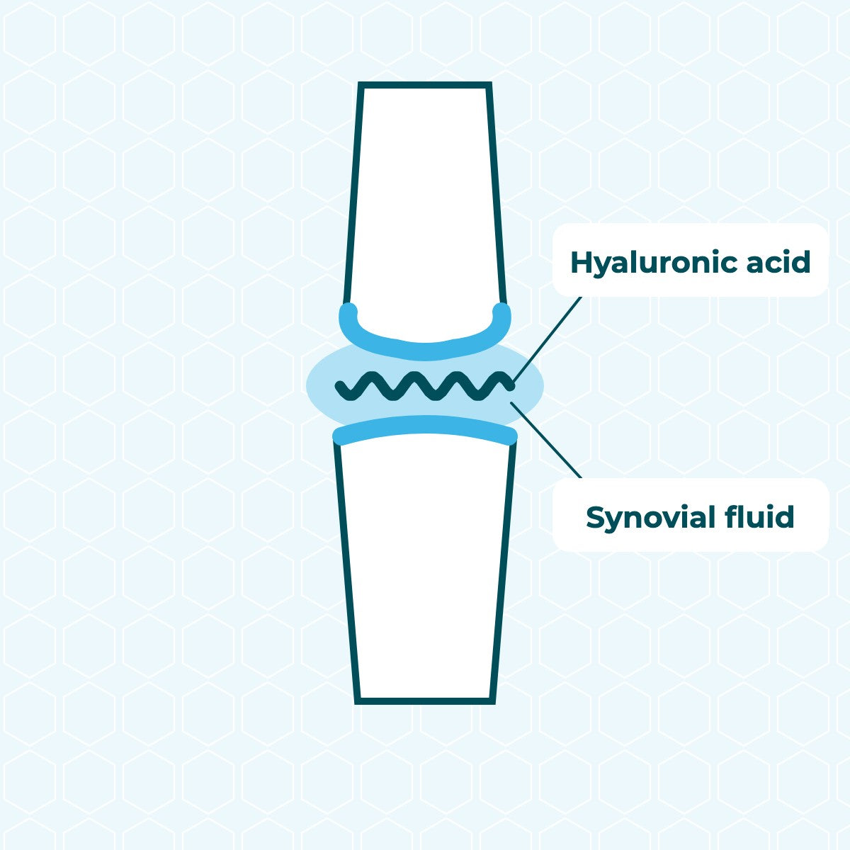 Illustration of the joint space: joint fluid between two bones, containing hyaluronic acid